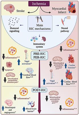 Remote Ischemic Conditioning in Ischemic Stroke and Myocardial Infarction: Similarities and Differences